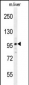 NARG2 Antibody  (N-term)