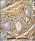 PCOTH Antibody (Center)