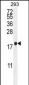 PCOTH Antibody (Center)