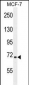 SEL1L Antibody (Center)