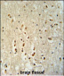 PTOV1 Antibody (N-term)