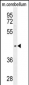 PTOV1 Antibody (N-term)