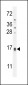 TCL6 Antibody (C-term)