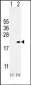 CDKN2C Antibody (C-term)