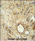 ITIH5 Antibody (C-term)