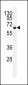 ZC12A Antibody (Center)