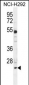 BCL7A Antibody (N-term)