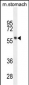 FEZF1 Antibody (N-term)