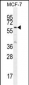 KARS Antibody (N-term)