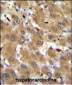 HPR Antibody (Center)