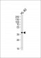 HPR Antibody (Center)