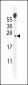 ECOP Antibody (Center)