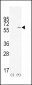 TIEG Antibody (Center)