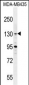 GLTSCR1 Antibody (Center)