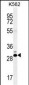 CT45A Antibody (N-term)