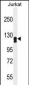 ADCY2 Antibody (Center)