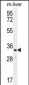 RLBP1L2 Antibody (C-term)