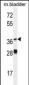 FADS6 Antibody (C-term)