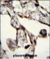 SASH1 Antibody (Center)