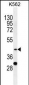 SPB4 Antibody (C-term)