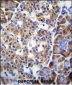 SMYD4 Antibody (C-term)