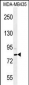 SMYD4 Antibody (C-term)