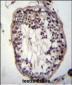 PRSS21 Antibody (Center)