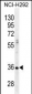 PRSS21 Antibody (Center)