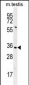 PRSS21 Antibody (Center)