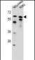 PLAG1 Antibody (N-term)