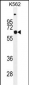 SLC16A8 Antibody (C-term)