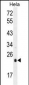 UQCRFS1 Antibody (C-term)