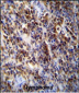 Parp9 Antibody (C-term)