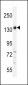 PALB2 Antibody (Center)