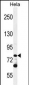 PCDHB10 Antibody (C-term)