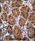 MUC3B Antibody (C-term E881)