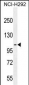 MUC3B Antibody (C-term E881)