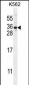 STARD6 Antibody (C-term)