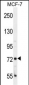 CTGE4 Antibody  (N-term)