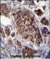 FRAT2 Antibody (C-term)