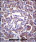 PRSS3 Antibody (Center)