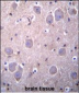 RAP1GDS1 Antibody (Center)