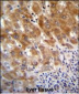 FAH Antibody (N-term)