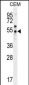 PSMAL Antibody (C-term)