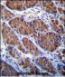 OTOP1 Antibody (Center)