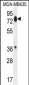 PCDHB13 Antibody (Center)