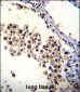 DOK3 Antibody (C-term)