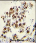 CYP5A1 Antibody (Center)