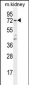 CYP5A1 Antibody (Center)