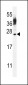 CT45A4/CT45A3/CT45A2/CT45A1/CT45A6 Antibody (Center)